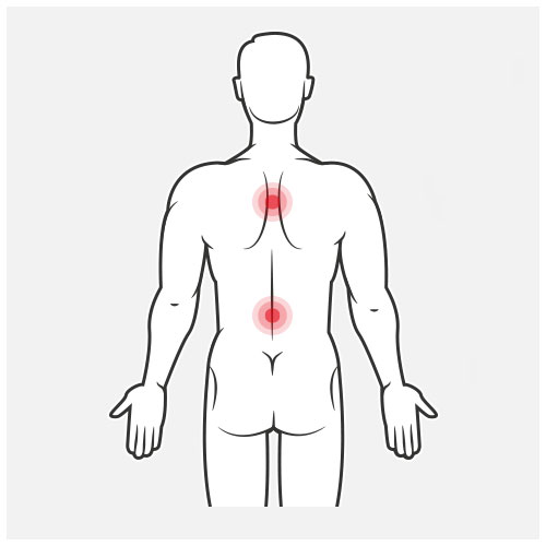 Ergonomie rugklachten