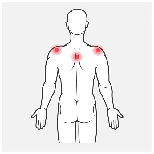 Ergonomie schouderklachten